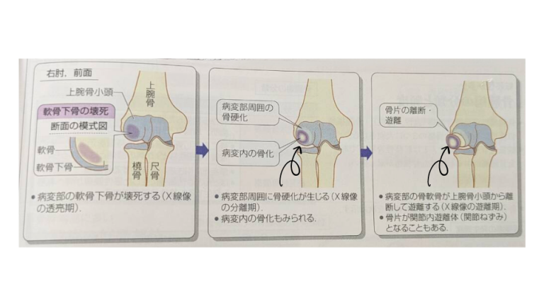 何が原因でしょうか?